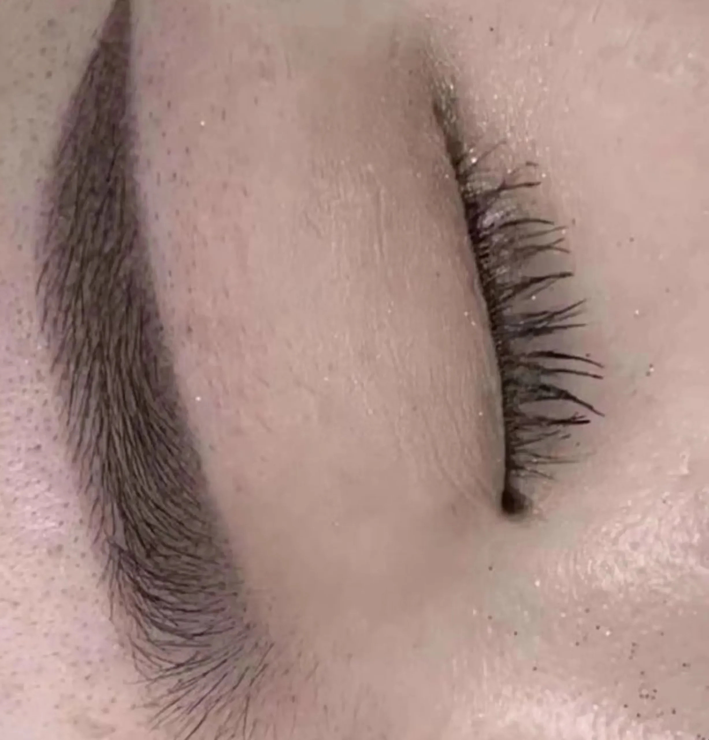 Eyeliner Tattoo Too Dark? Causes & Fixes for Thick Tattoos